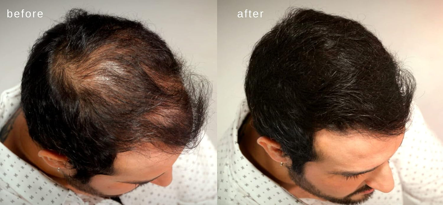 Volumizing Hair Fibers with real Keratin for Thinning Hair/Hair Loss – Dermatologist Tested and Certified Hypoallergenic - 60 days + supply - Multiple Colors Available (Light Brown)