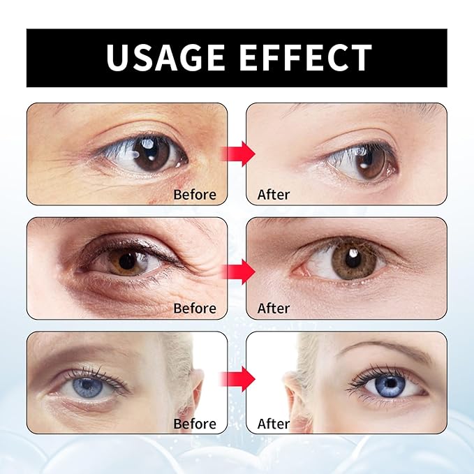Berbax™ Eye Cream - Instant Tightening Eyelid Firming Cream for Anti-Aging Fine Lines & Under Eye Tightening
