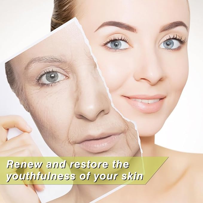 Elves Pdo Threads for Eyes Lift Mono Screw Type 30g38mm Pdo Lifting Thread for Fox Eye 40pcs Pdo Threads for Face Lift with Blunt Tips Smooting Eye Wrinkles Improves Skin's Firmness and Elasticity