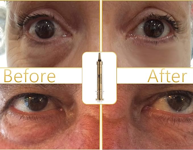 GLO24K Complete Eye Care Set with our 24k Instant Facelift Cream, Eye Cream, and Eye Serum