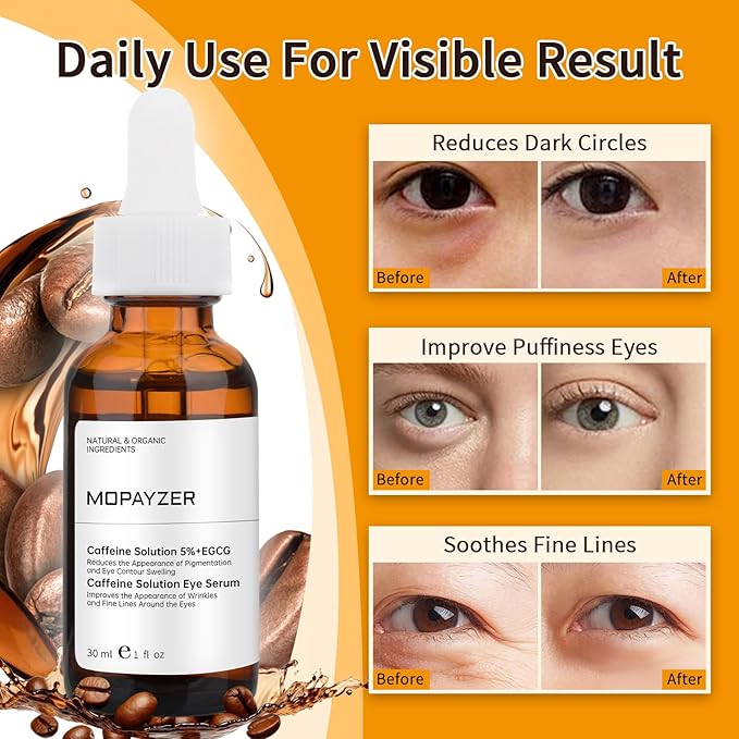 Caffeine Solution 5% + EGCG, Caffeine Eye Serum For Moisturizing, Targets Dark Circles & Puffiness, 1 PCS Natural Under Eye Serum For Facial Wrinkles & Fine Lines.