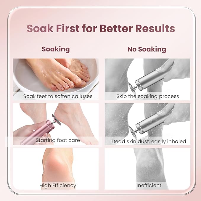 Electric Callus Remover for Feet, Adjustable Speed Foot Callus Remover, Professional Pedicure Tools for Feet with 60 Pcs Replacement Sandpaper Disc, Foot Scrubber for Dead Skin and Calluses