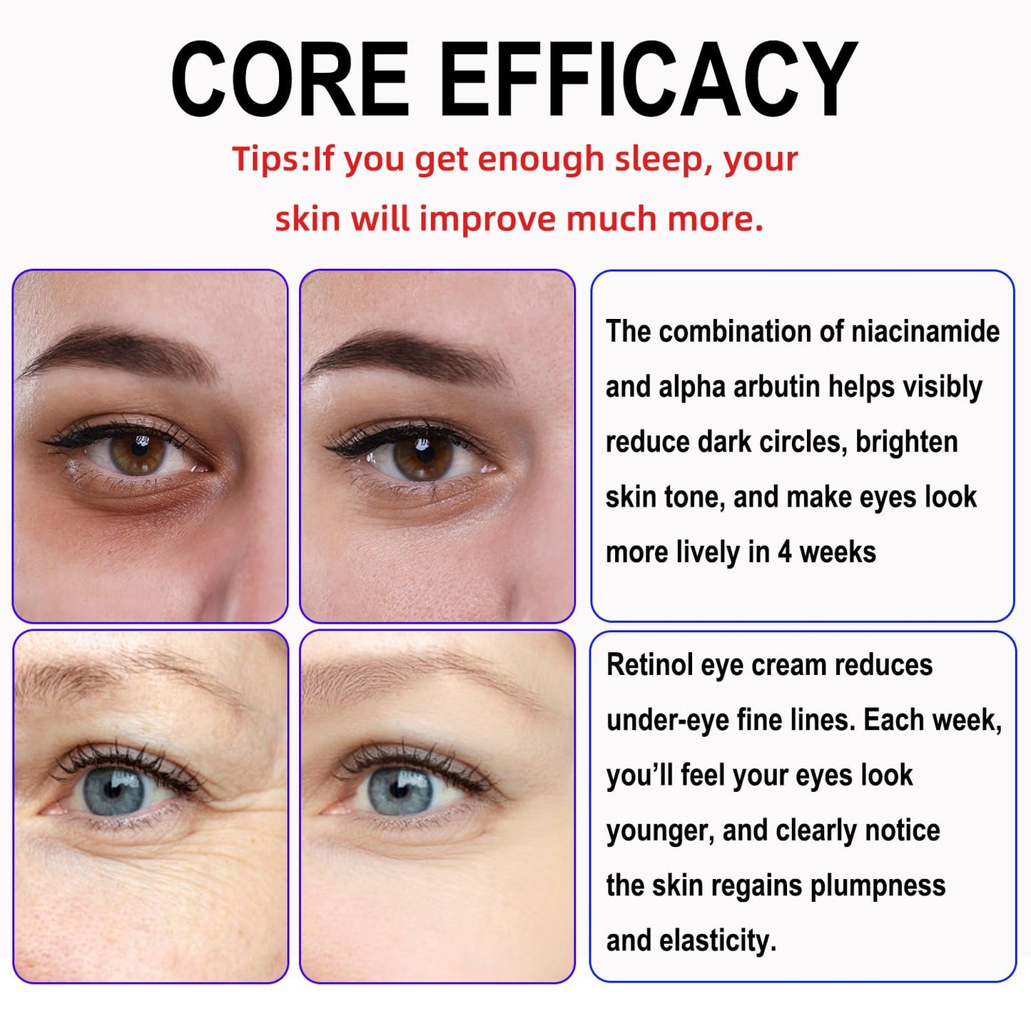 Retinol Eye Cream with Niacinamide, Hyaluronic Acid & Vitamin E – Hydrating Under Eye Cream for Visible Dark Circles, Wrinkle Appearance & Under-Eye Fullness, Anti Aging