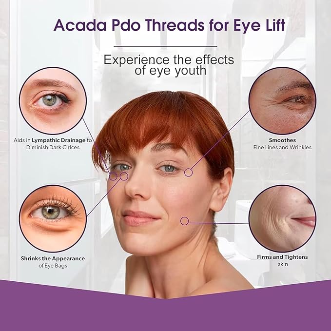 ACADA Pdo Threads for Eye Lift Face Lift Pdo Screw Threads for Eyes lift 30G25mm 40Pcs B-Type, Pdo Periocular Threads, Pdo Threads Eyes