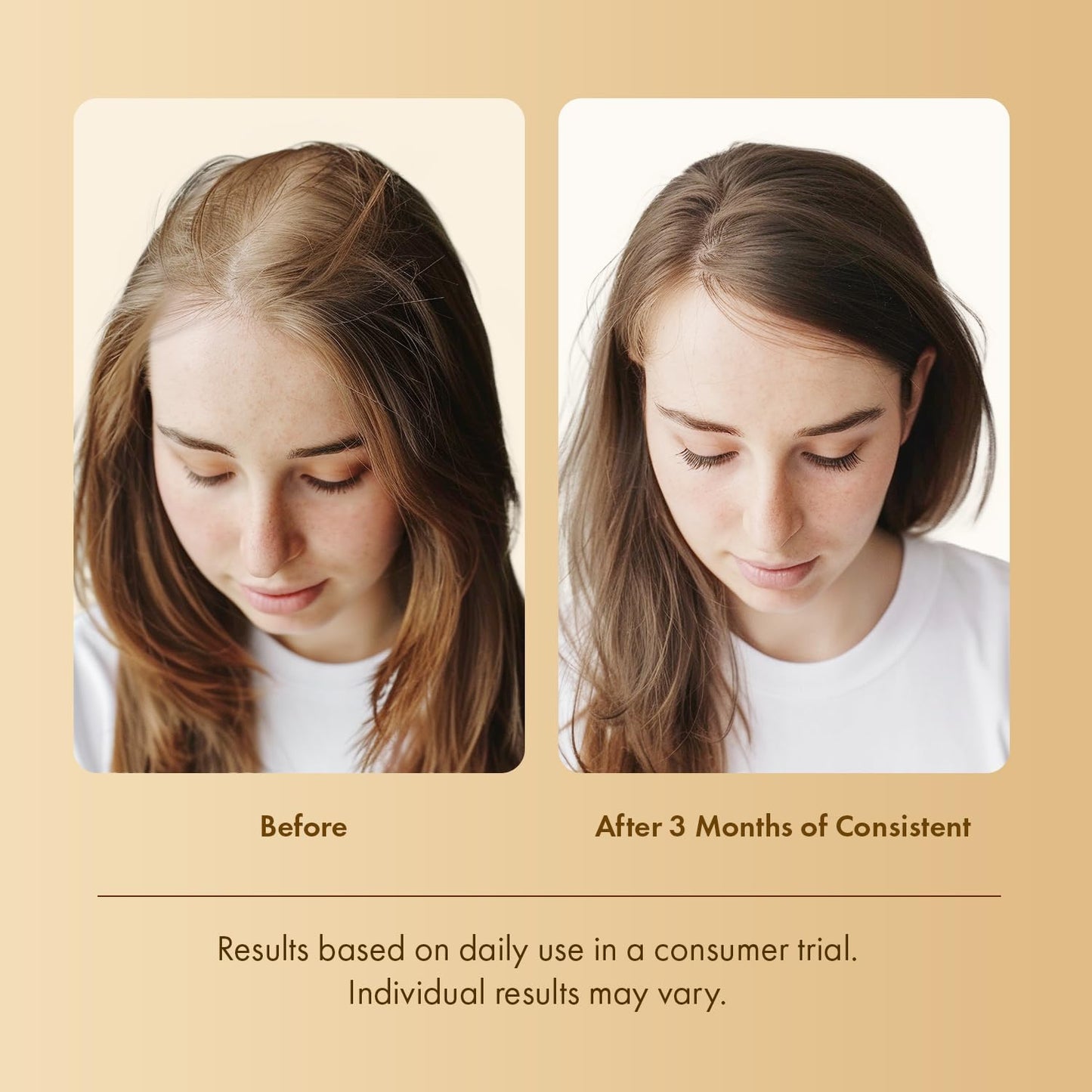 EarthShine Advanced Hair Growth Serum: 50mL Anti-Hair Loss Scalp Serum - Hair Thickening Serum with Amino Acids, Caffeine & Rosemary Oil Promotes Healthy Scalp & Fuller-Looking Hair