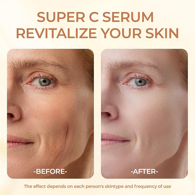 Super Vitamin C Serum for Women Mature Skin- Hydrating Anti-Aging with Vitamin C Caffeine - Facial Skin Care Over 50 60 70, Firming, Lifting, Smoothing 1.69 fl oz