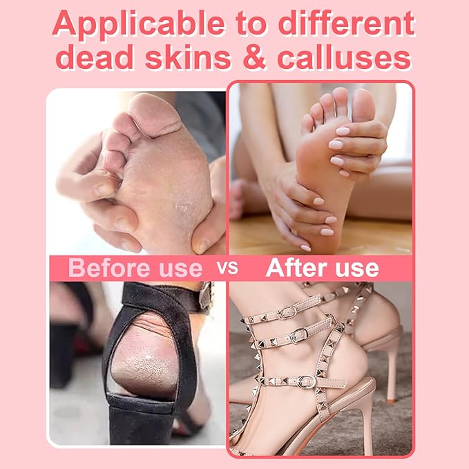 High Torque Electric Foot File - Callus Remover for Feet,Adjustable Speed Foot File with 60 Pcs Sandpaper Discs,Professional Pedicure Tool for Dead Skin and Calluses (Gradient Pink)