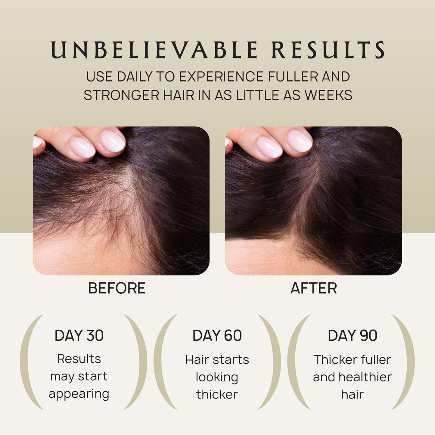 Hair Growth Oil Spray - 100% Pure Ingredients For Non Greasy, Thicker & Stronger Hair - Organic Batana, Castor, Biotin, Saw Palmetto, and Rosemary Oil Gifts for Men & Women Scalp - 4.1 Fl Oz