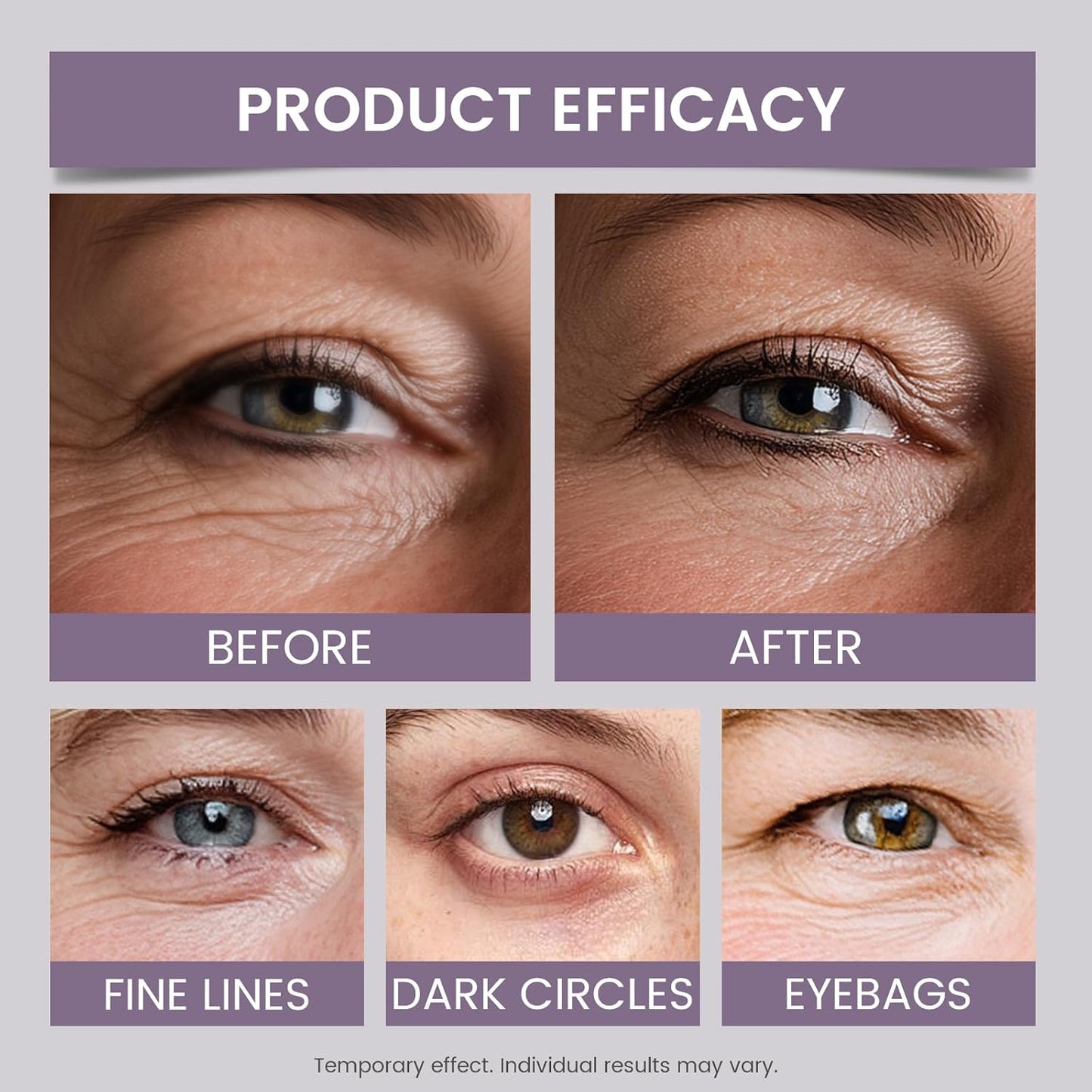 Lynz Pure Instant Eye Tightener, Temporary Firming Eye Cream & Makeup Primer, Smoothes Fine Lines & Minimizes Pores, No Filter Eye Primer 30ml