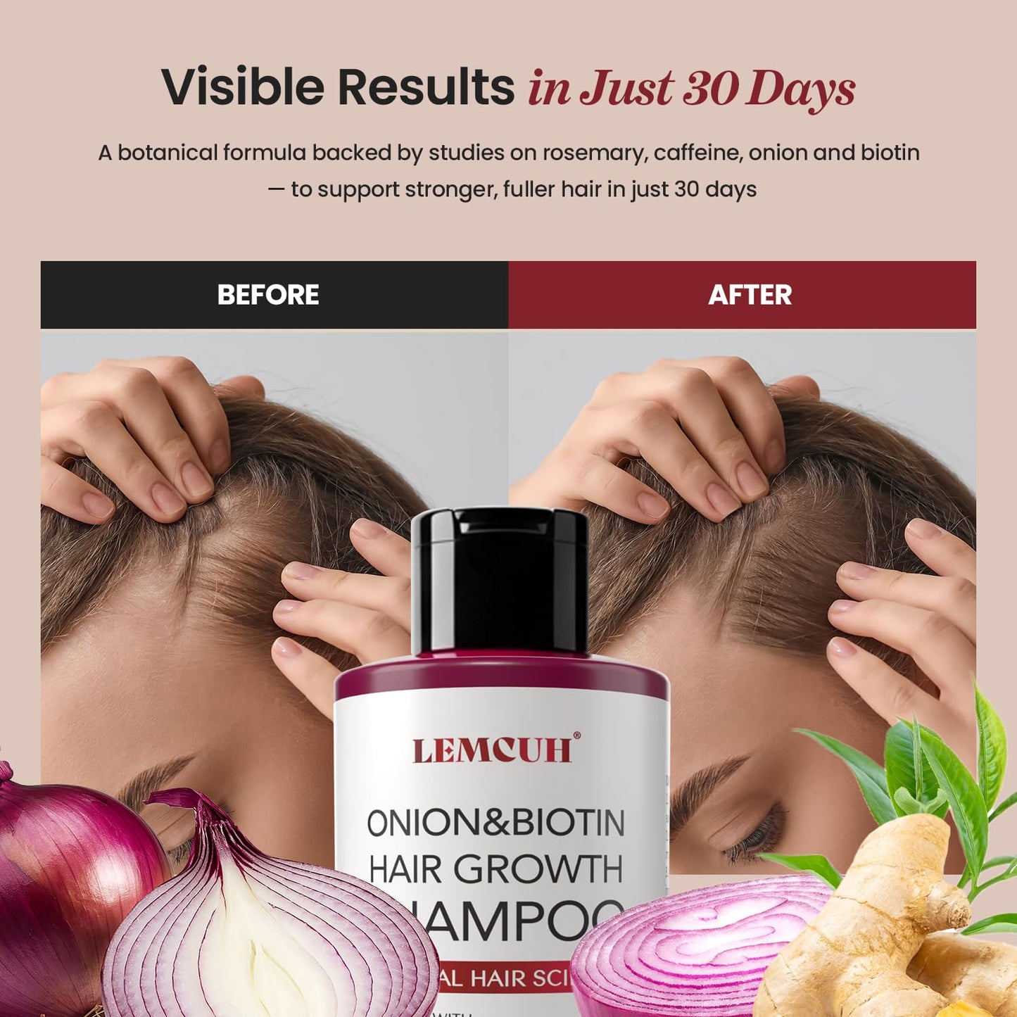 Onion & Biotin Hair Growth Shampoo: Infused With Natural Rosemary Tea Tree Oil Anti Hair Loss Shampoo - Scalp Smooths Thickening Formula Support Hair Regrowth For Women Men (12.5 Fl Oz)