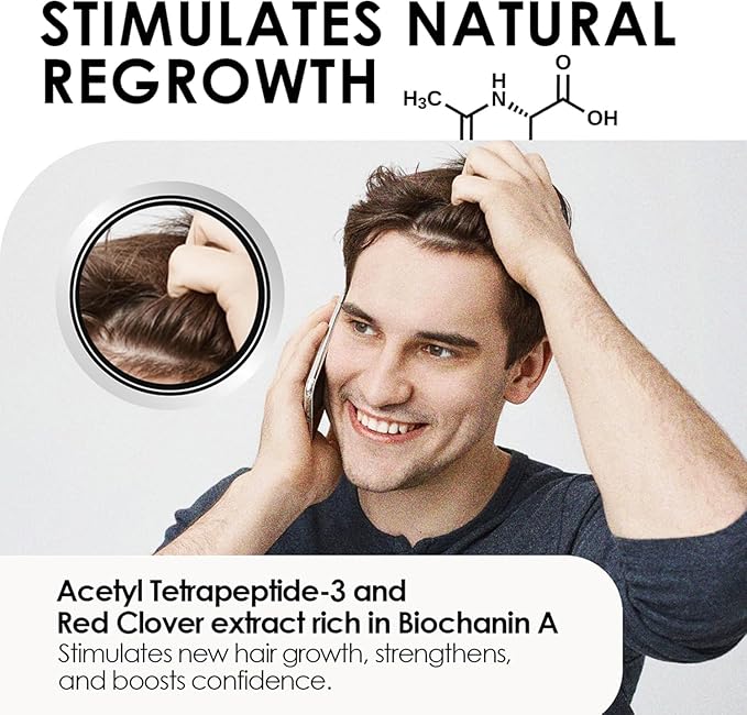 Men’s Root Stimulating Leave-In Serum for Thicker, Fuller-Looking Hair – Daily Vegan Hair Strengthener with Biotin, Caffeine & Saw Palmetto – Lightweight, Fast-Absorbing Formula