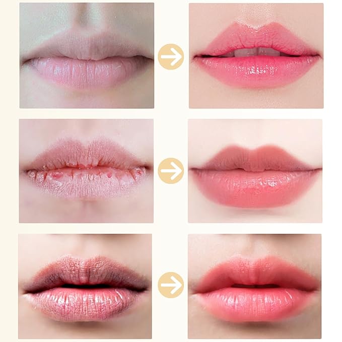 Lip Sleeping Mask - Lip Balm Hydrating - Lip Mask Overnight - Lip Butter Balm - Lip Moisturizer for Very Dry Lips - Extreme Dry Lips Treatment - Lip Plumper for Women - Lip Filler Lip Collagen