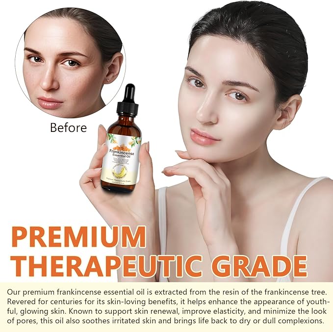 Premium Frankincense Essential Oil – 100% Pure & Natural, Therapeutic Grade for Skin, Face & Aromatherapy | Best Frankincense Oil for Face, Wrinkles & Scars | Deeply Nourishing