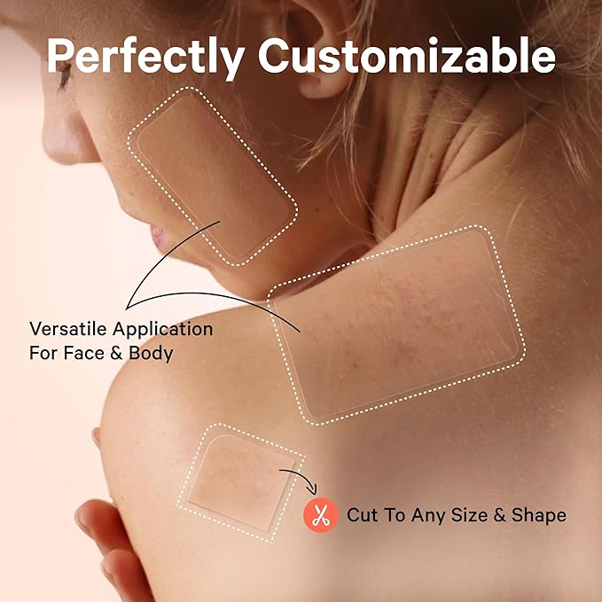 Sosky Large Pimple Patches XL Hydrocolloid Acne Patches for Face & Body Cystic Pimple & Zit Patch for Nose Chin Back, Bacne & Breakouts Vegan Cruelty-Free（8 Count）