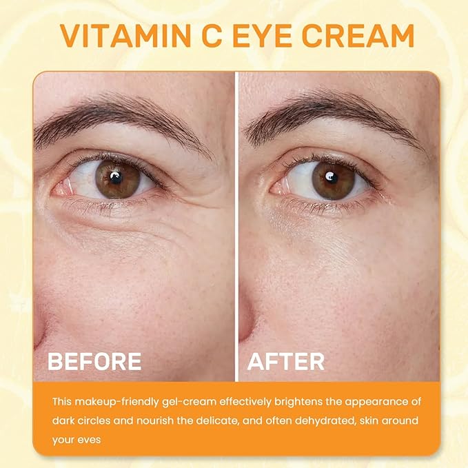 Vitamin C Eye Cream For Dark Circles, Under Eye Cream Anti Wrinkles For Reduce Puffiness And Bags Fine Lines, Wrinkles, Hydrating Eye Lifting Skin Care Anti Aging Eye Cream(0.7 FL.Oz)
