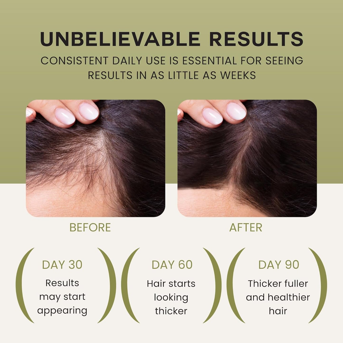 Batana Oil For Hair Growth - 100% Pure, Raw & Natural Blend With Organic Castor, Pumpkin Seed, Coconut and Rosemary Oil - Thicker, Stronger Hair Gifts For Men & Women Scalp (1 Pack)