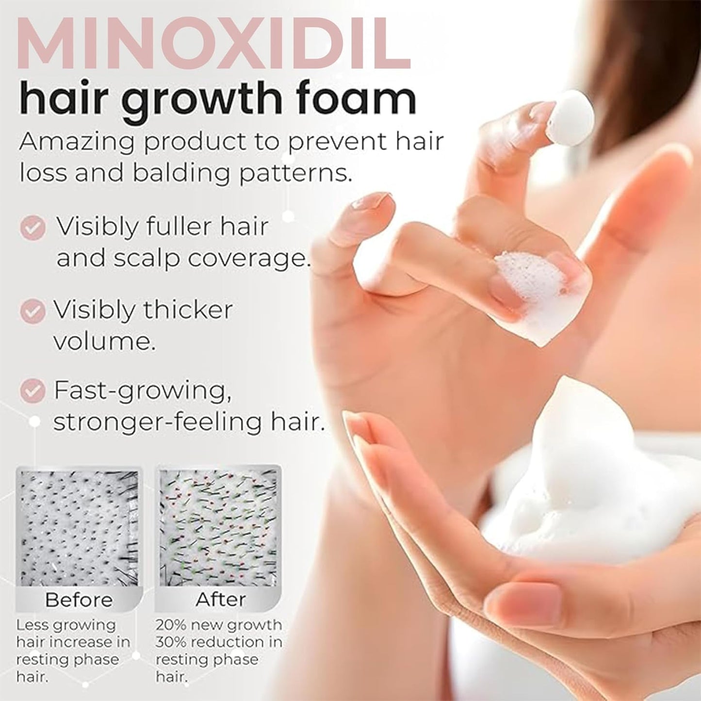 Minoxidil for Women | 5% Minoxidil For Women Hair Growth | Hair Regrowth Treatment | Unscented Topical Foam | Dermatologist Recommended | Clinically Proven Formula | 3 Month Supply