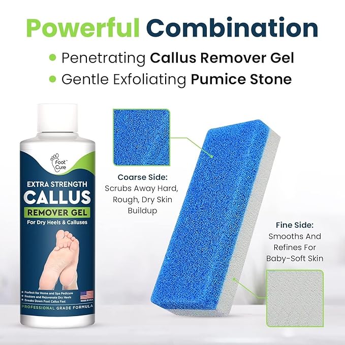 Callus Remover for Feet with Extra Strength Gel & Foot Pumice Stone Set - Easy Way to Remove Hard Calluses & Dead Skin Build-Up - Professional at-Home Foot Care for Men & Women - Made in The USA
