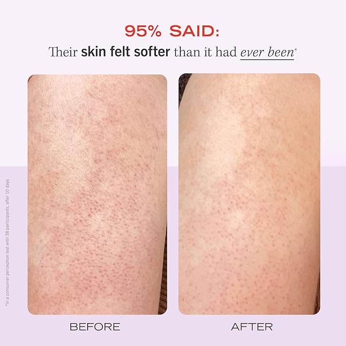 First Aid Beauty - KP Bump Eraser Body Scrub with 10% AHA, Keratosis Pilaris Exfoliator with Glycolic and Lactic acids, Helps Reduce Chicken Skin Bumps, Safe for Sensitive Skin, Strawberry Scent, 2 oz