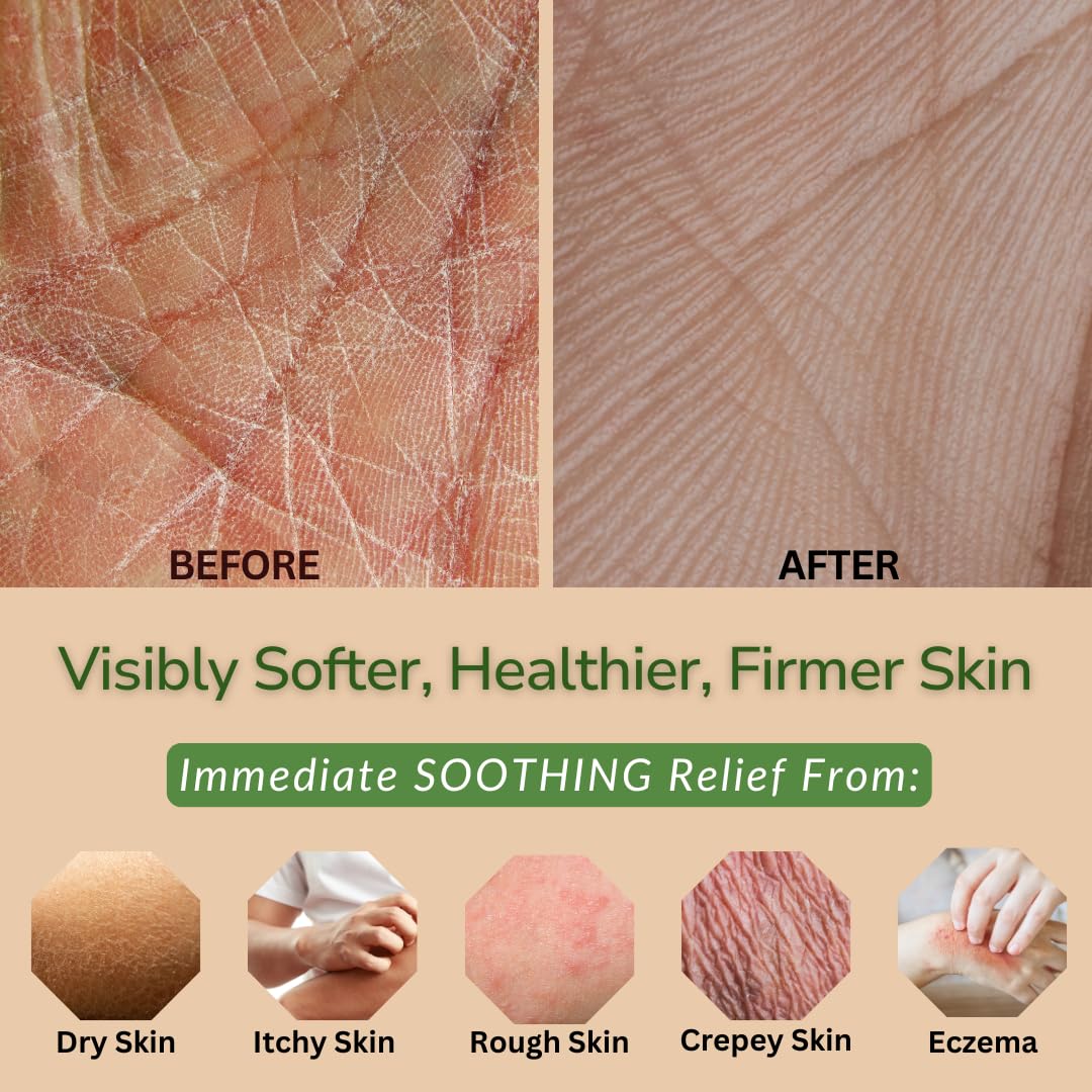 Moisturizing & Firming Lemongrass Body Lotion & Hand Cream - Natural Moisturizer for Dry Skin, Itchy or Crepey Skin - Eczema Treatment - Olive Oil, Coconut Oil & Avocado Oil - 8oz