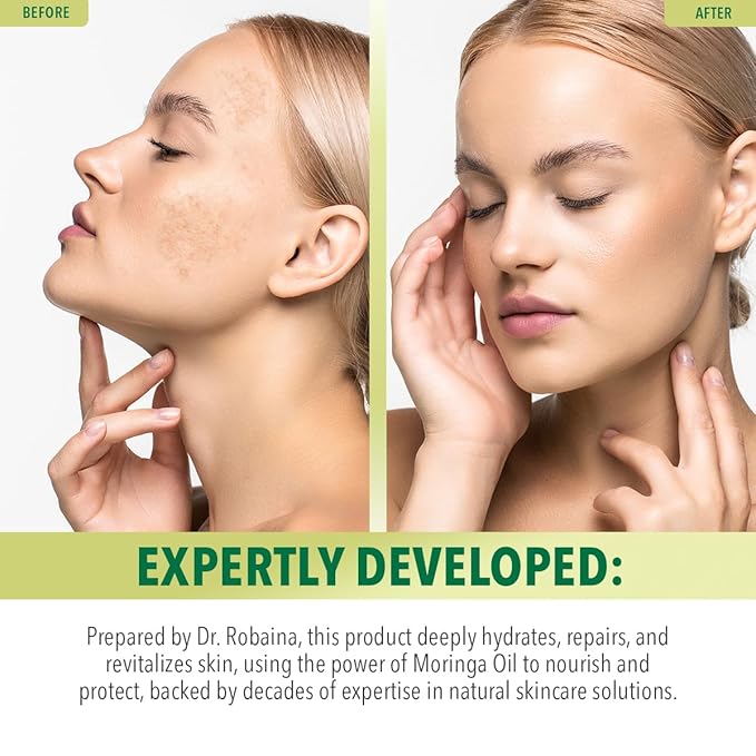 Dr. Robaina 100% Pure Organic Moringa Seed Oil – Cold-Pressed, Unrefined & Hexane-Free Face, Hair & Nail Moisturizer – Fast-Absorbing Non-Greasy Hydration – 2 fl oz Dropper Bottle – Made in USA