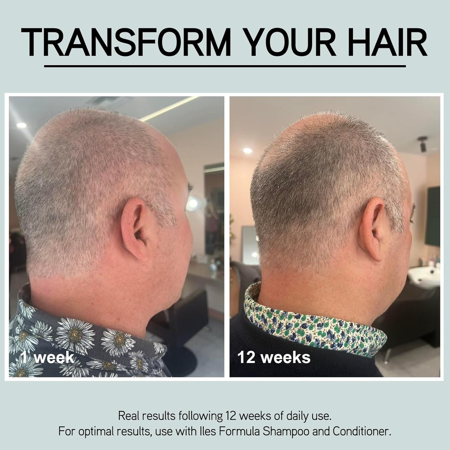 ILES FORMULA Grey Delay Booster – Anti-Gray Leave-In Hair Treatment, Prevents Premature Graying & Stimulates Melanin Production, Plant-Based w/Chios Mandarin & Matsutake Mushroom, 1.7 fl oz (50 ml)