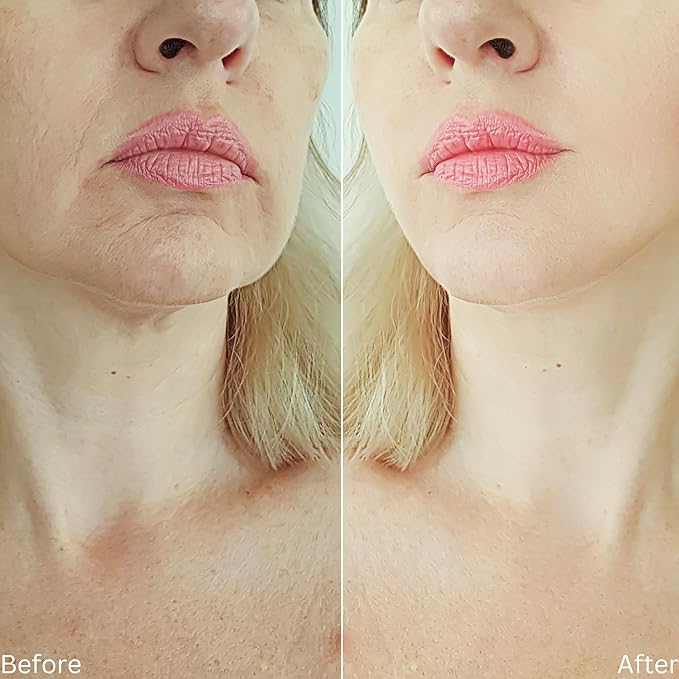 Retinol 3%, Collagen Face Cream with 5% Hyaluronic Acid, Moisturizer, Anti-Aging, Firmer, Reduce Fine Lines and Wrinkles, Radiant Skin