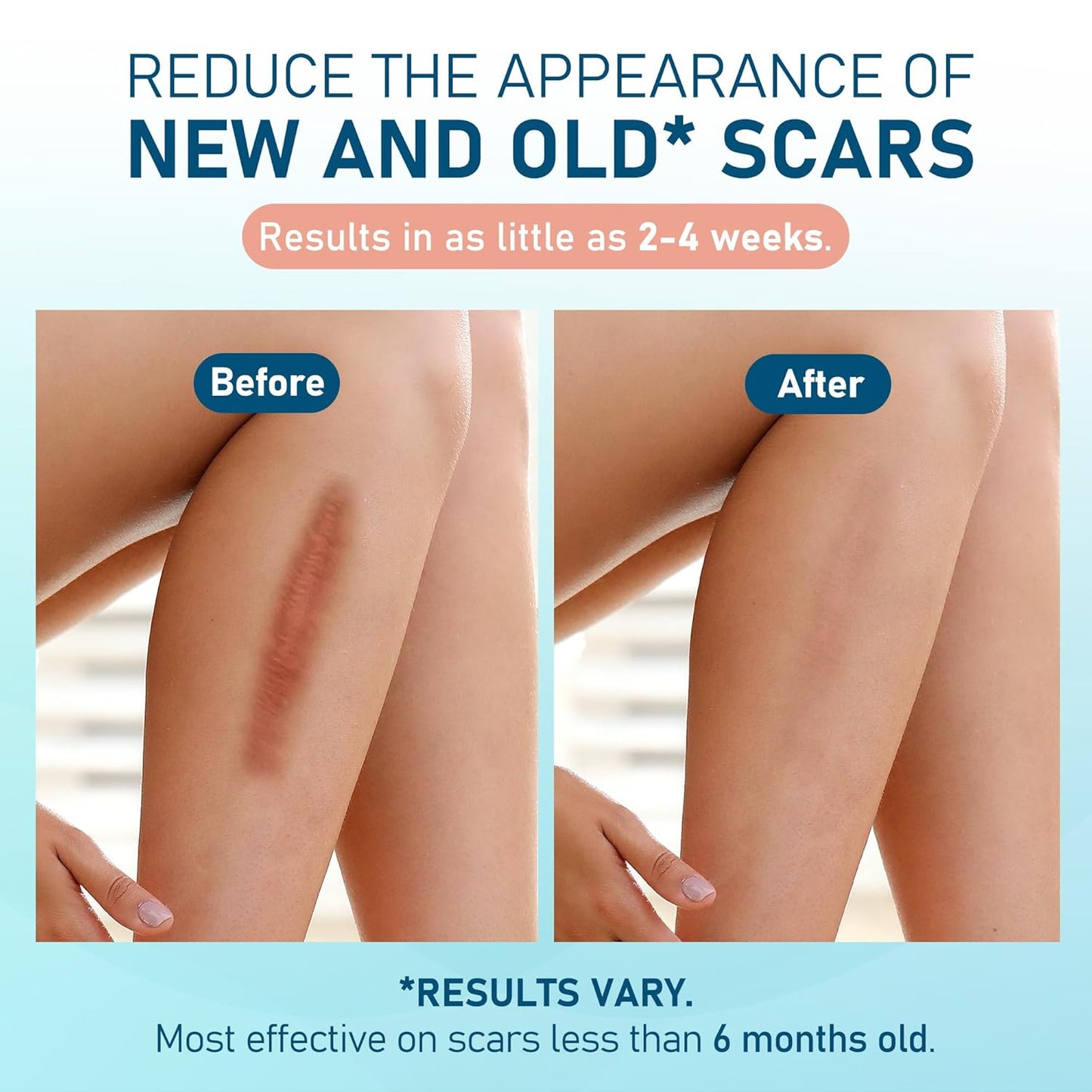 Silicone Scar Sheets, 10pcs, Silicone Tape for Scar Treatment, Reusable Scar Strips for Surgical, C-Section, Keloid Bump, Stretch Marks, Burn, Acne Scar Removal, Each 1.5” x 6”