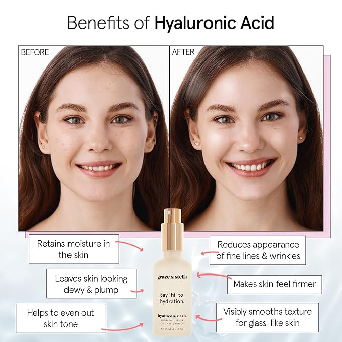 grace & stella Award Winning Hyaluronic Acid Serum (30 ml/1 fl oz) Hyaluronic Acid Serum for Face - Acido Hialuronico Face Serum for Women - Hydrating Serum Remove Fine Lines, Wrinkles - Anti Aging