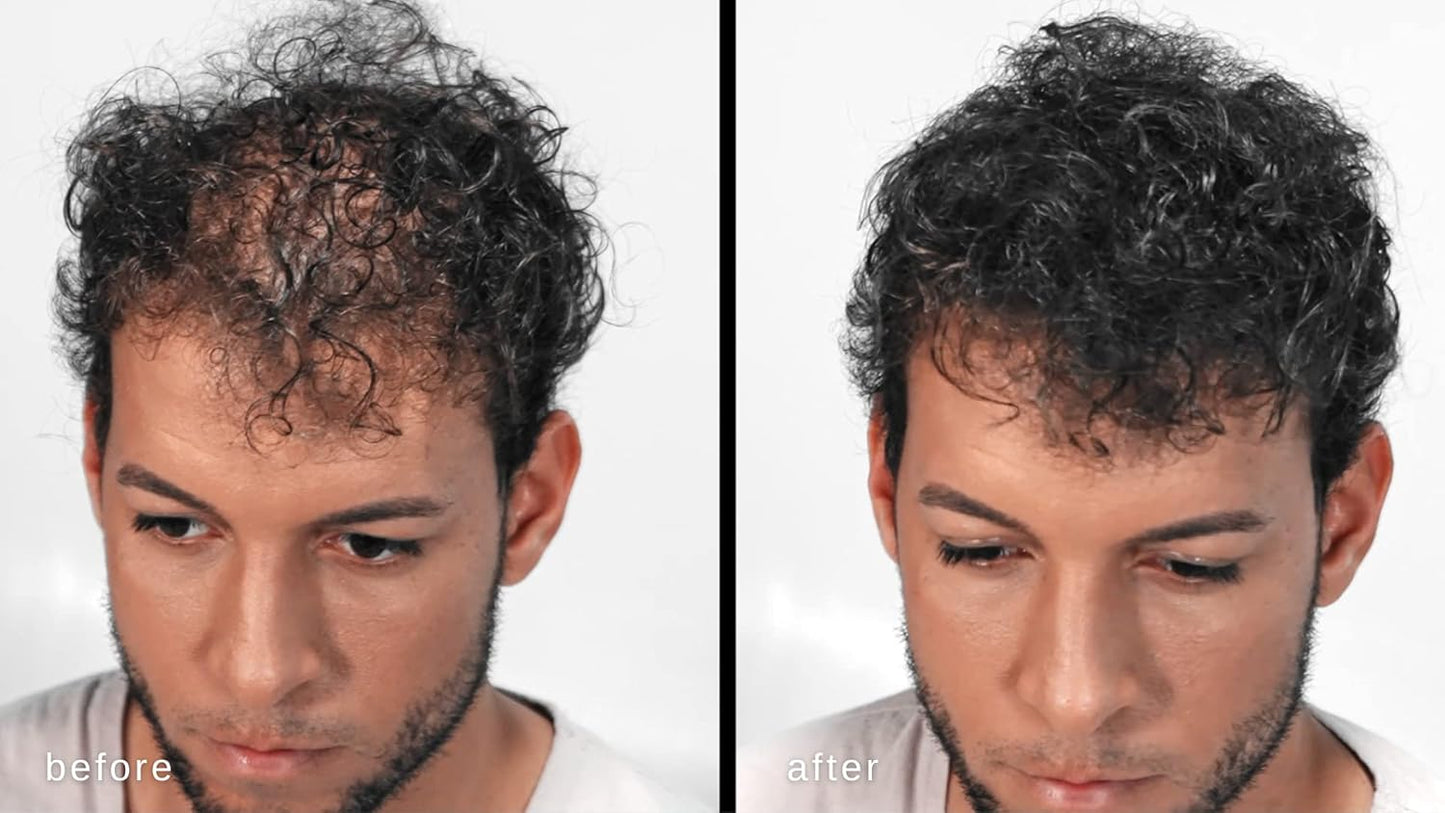 Hair Building Fibers - Volumizing Hair Fibers with real Keratin for Thinning Hair/Hair Loss Dermatologist Tested and Certified Hypoallergenic - 60 days + supply (Medium Brown)