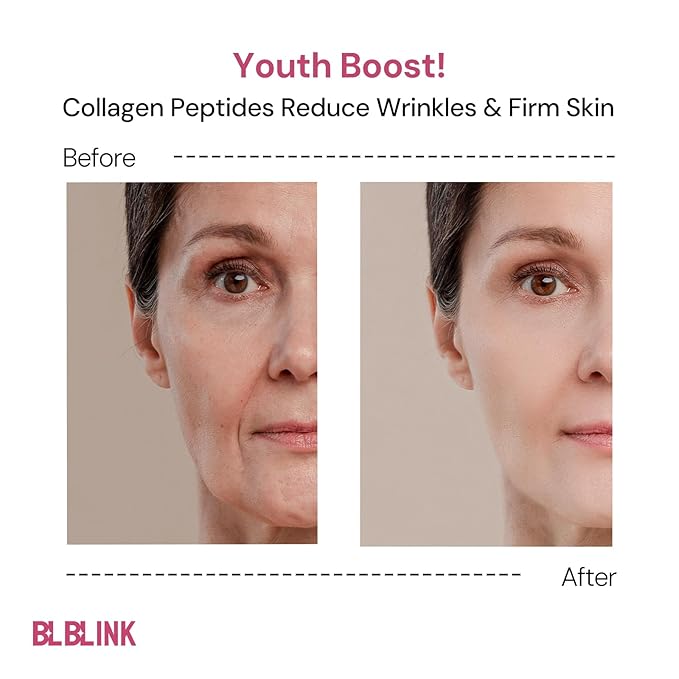 Hydrogel Collagen Face Mask 34g x5 Sheets– 8D Hyaluronic Acid + SYNE-AKE Peptide, Anti-Aging Jelly Sheet for Deep Hydration, Pore Tightening, Sensitive Skin Safe, 1 Mask = 1 Ampoule