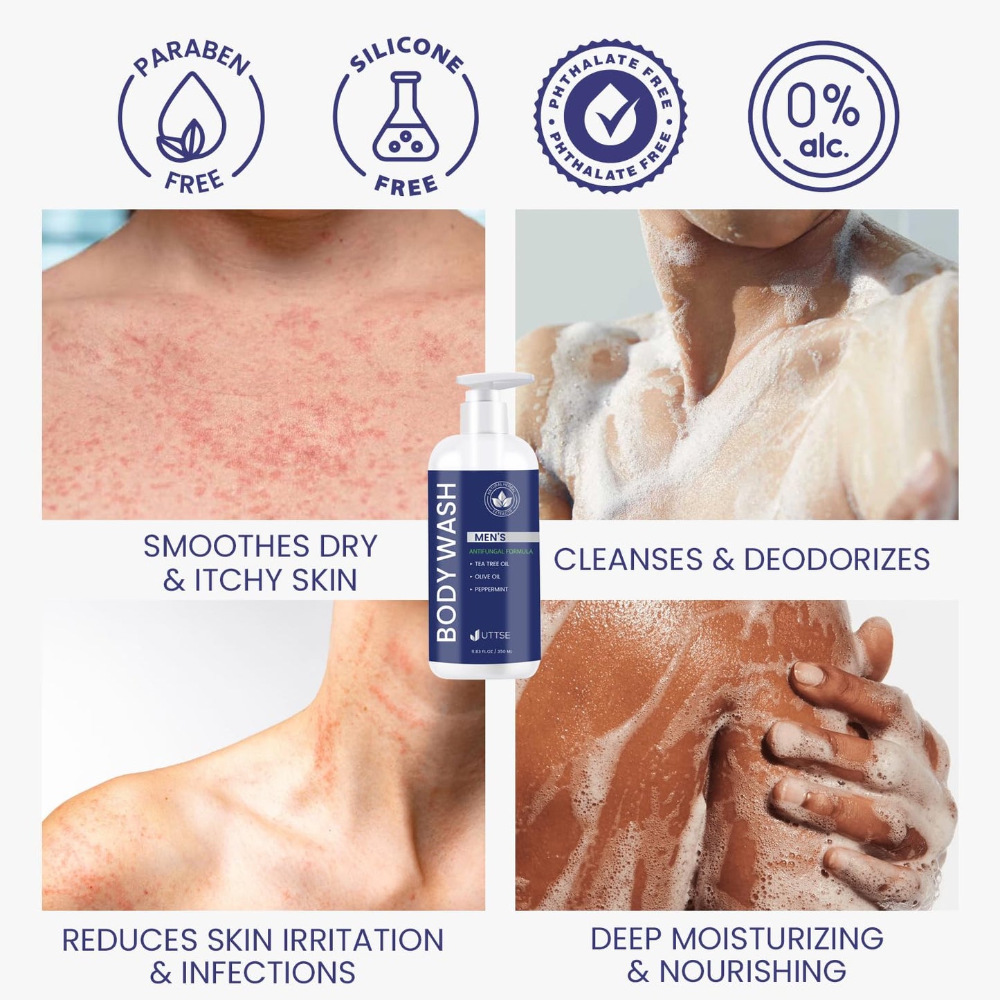 Tea Tree Body Wash: Antifungal Soap for Men - Eliminates Body Odors & Skin Irritations - 11.8fl oz/350mL