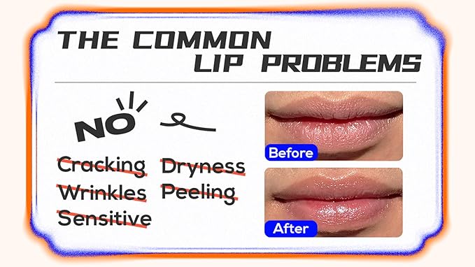 Goji Ectoin Recovery Lip Balm | Nourishing & Non Greasy Lip Treatment | Papaya Enzyme, Goji, Ectoin, Vitamin C to Support Lip Barrier & Wrinkles | For Dryness Cracked Lip Day & Night Use