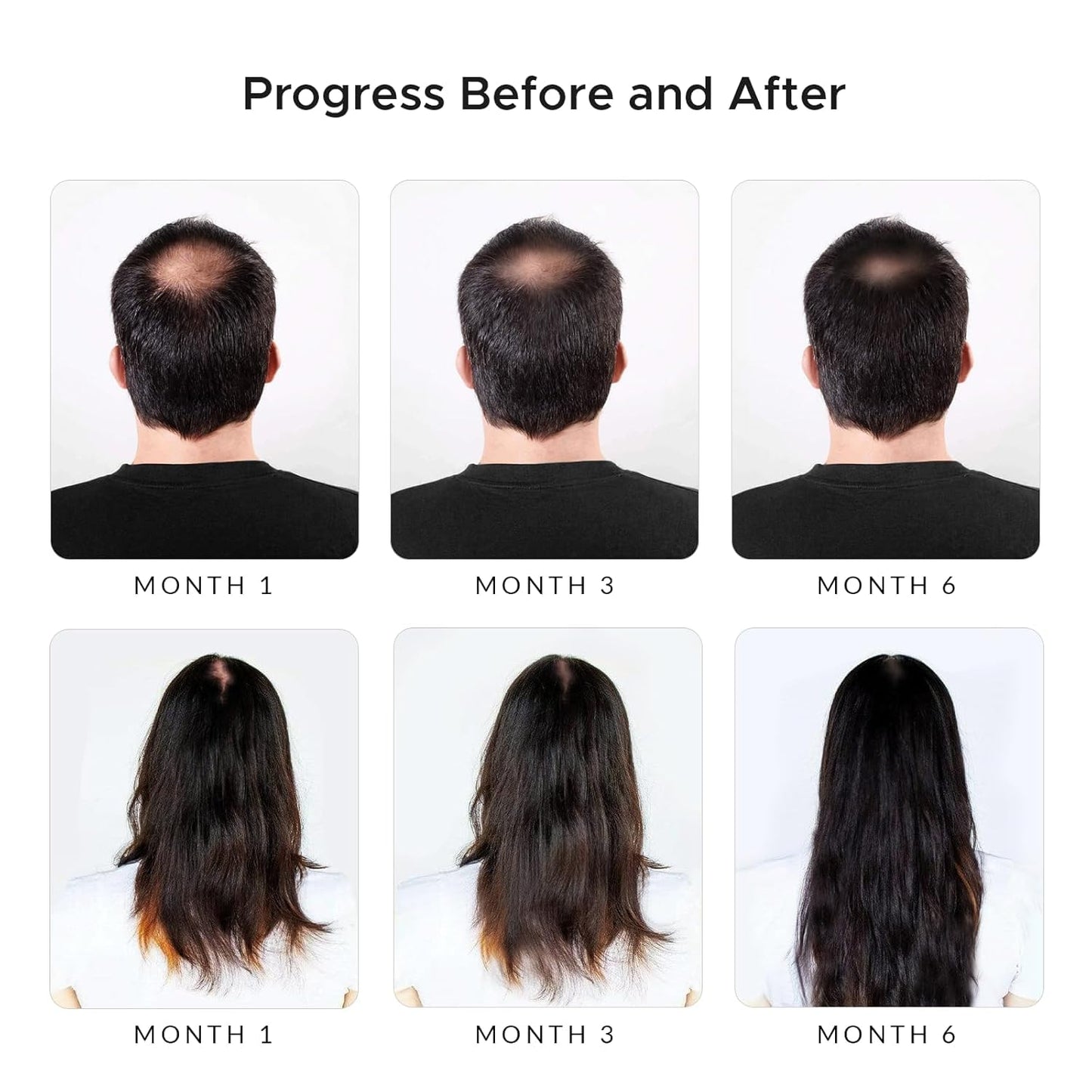 Generic Rivermint Shampoo with Hyaluric Acid and Biotin: Hair Growth Stimulant for Men and Women, anti hair loss - Made in the USA