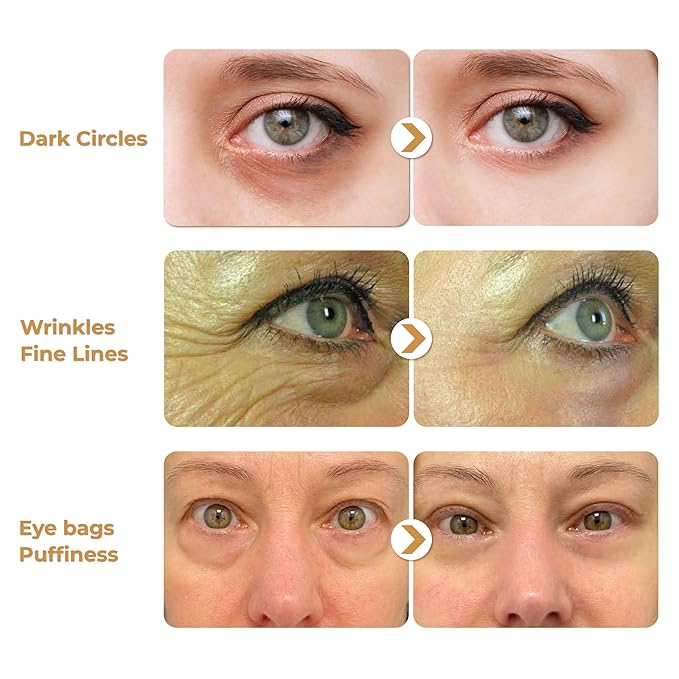 ABERA Natural Repair Eye Cream, Minimizes Under Eye Bags & Puffiness, Reduce Wrinkles, Fine Lines and Dark Circles, 0.5 fl oz