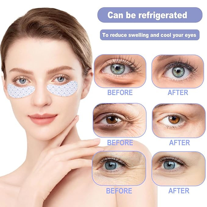 Reusable Eye Patches, 2 Pairs Silicone Under Eye Patches for Fine Lines & Dark Circles with Metal Eye Cream Applicator, Visible Metal Case