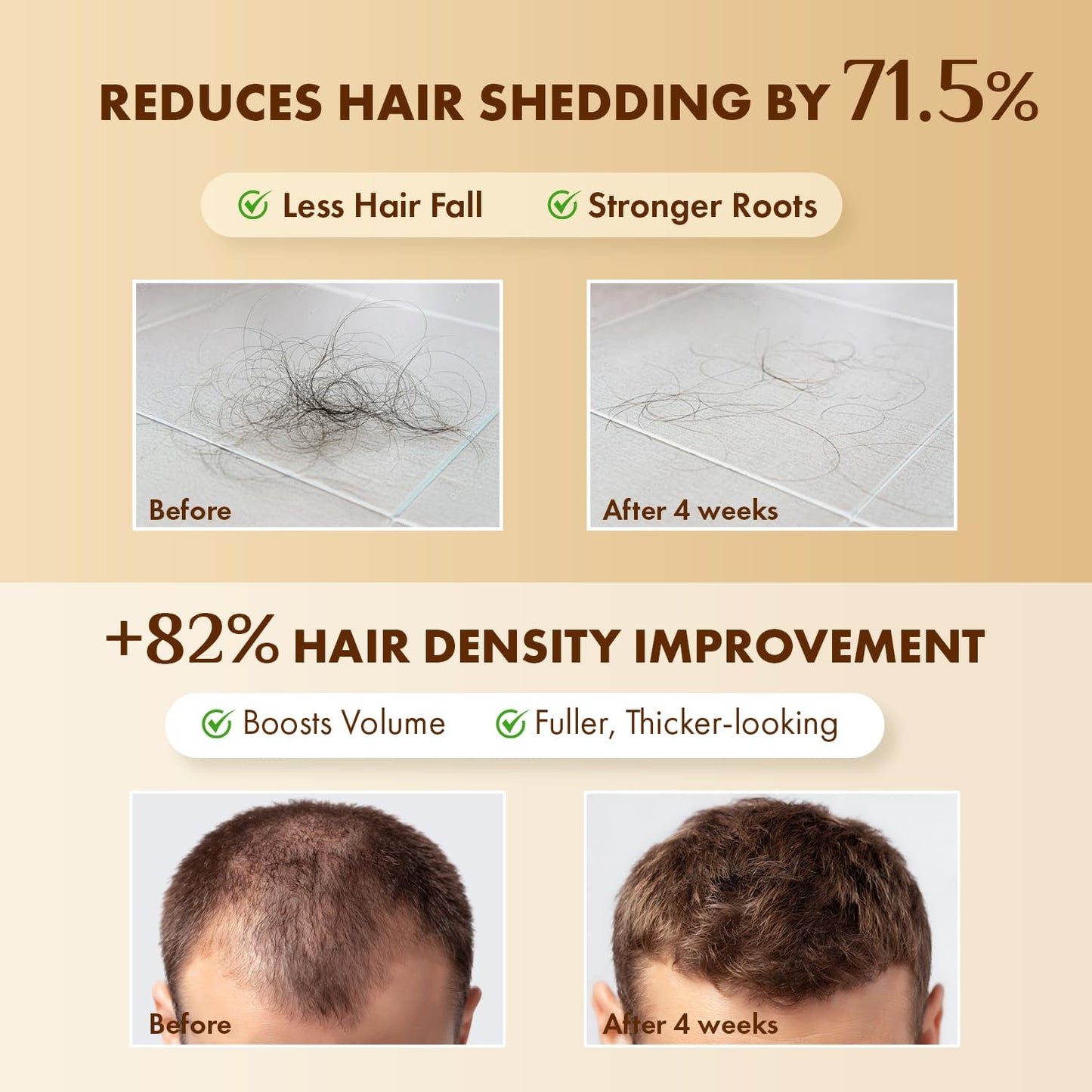 EarthShine Advanced Hair Growth Serum: 50mL Anti-Hair Loss Scalp Serum - Hair Thickening Serum with Amino Acids, Caffeine & Rosemary Oil Promotes Healthy Scalp & Fuller-Looking Hair
