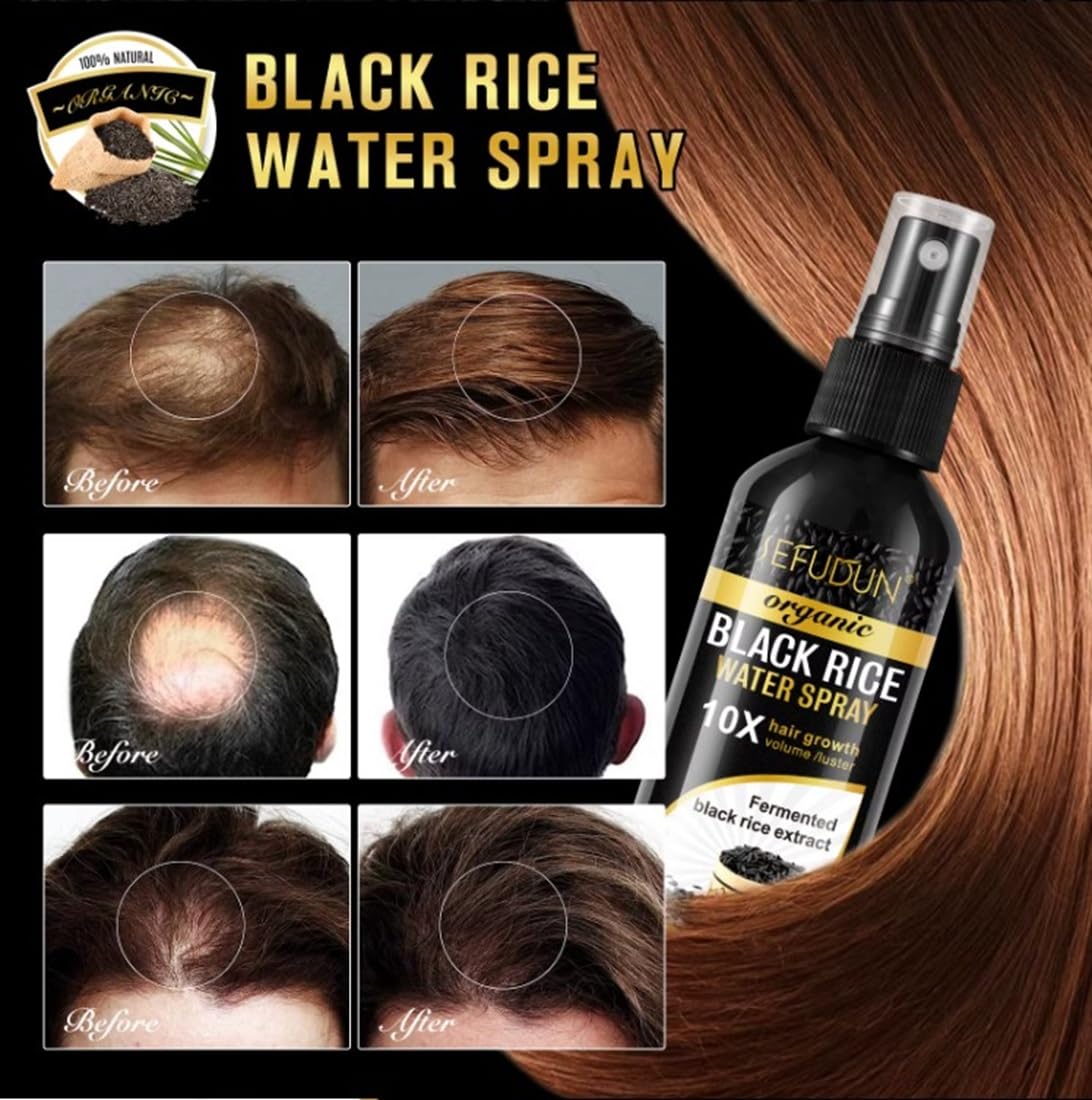 Organic Black Rice Water Spray for Hair Growth, with Castor Oil & Ginger Root Extract for Thicker, Fuller Hair, Helps in Hair Loss and helps Repair Damage 100ml/3.2 fl. Oz (1 PC) - ActivePur