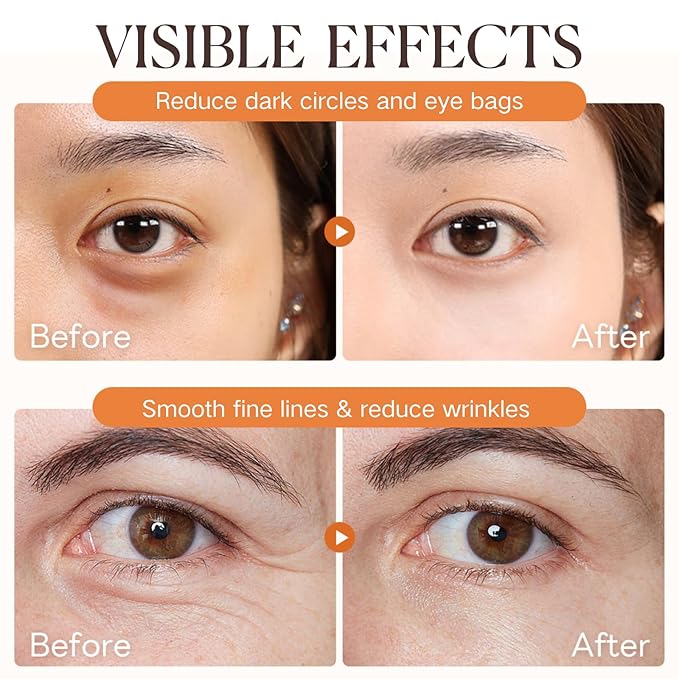 2PCS Retinol Eye Stick - Retinol Eye Cream Anti Aging - Under Eye Cream for Da rk Circles - Serum for Puffiness and Bags under Ey es - Skin moisturizer for Women Hydrates,Firms,Smooth（2pcs）