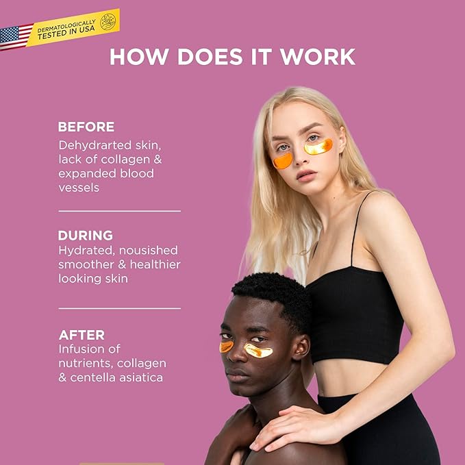 Under Eye Patches for Dark Circles & Puffiness – 20 Pairs with Collagen, Aloe & Gold – Anti-Wrinkle Eye Masks for Women – Hydrating Eye Treatment