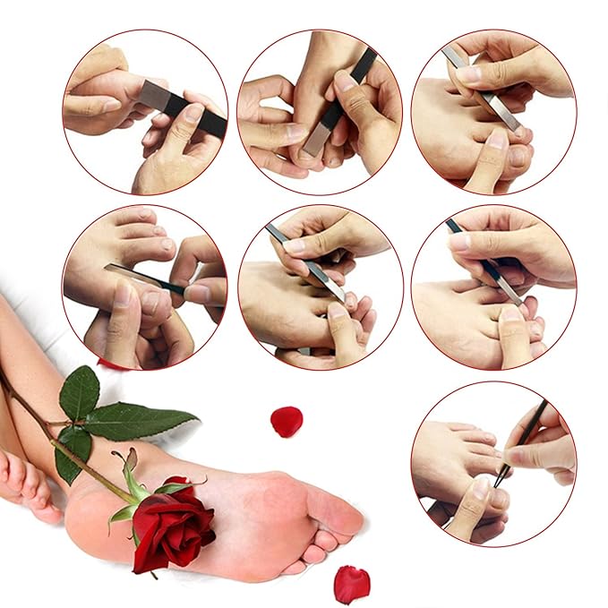 Pedicure Knife Set for Feet, Segbeauty 7pcs Ingrown Toenail Blade Tool with Storage Bag, High Manganese Steel Nail Knives Cuticle Remover, Professional Foot Repair Sharp Blade Kit for Nail Corn Callus