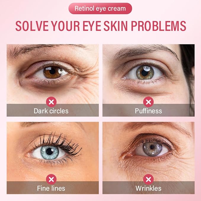 Retinol Eye Cream for Dark Cir-cles - Eye Cream Anti Aging - Hydrating eye Care Products - Eye Serum - Anti-Wrinkle Eye cream for Puffiness and Bags - Nourishing Skincare for Girls 10-12