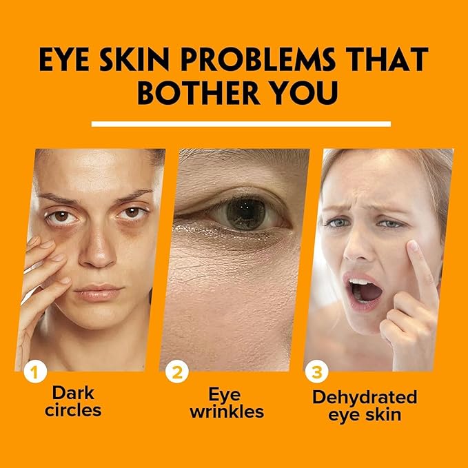 2PCS Retinol Eye Stick for Anti Aging, Turmeric Eye Cream for Dark Circles and Puffiness Fine Lines Moisturizer Under Eye Balm Stick Hydrating Eye Cream with Retinol Stick 5g/pc