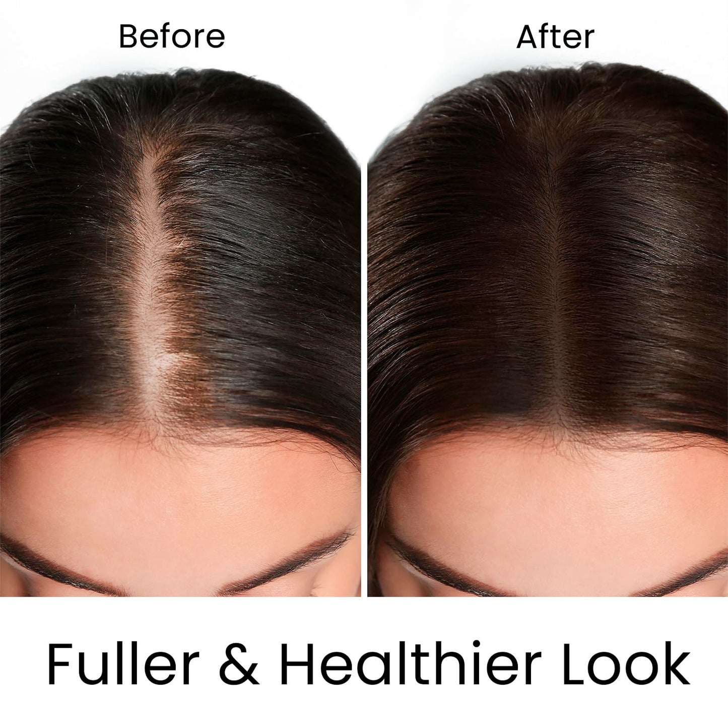 MOEHAIR Hair Guard Shampoo | Stimulates Hair Follicles | Hair Thickening and Volumizing Shampoo | Infused with Argan Oil, Ginseng & Vitamins | Paraben & Sulfate Free (12 Fl. Oz)