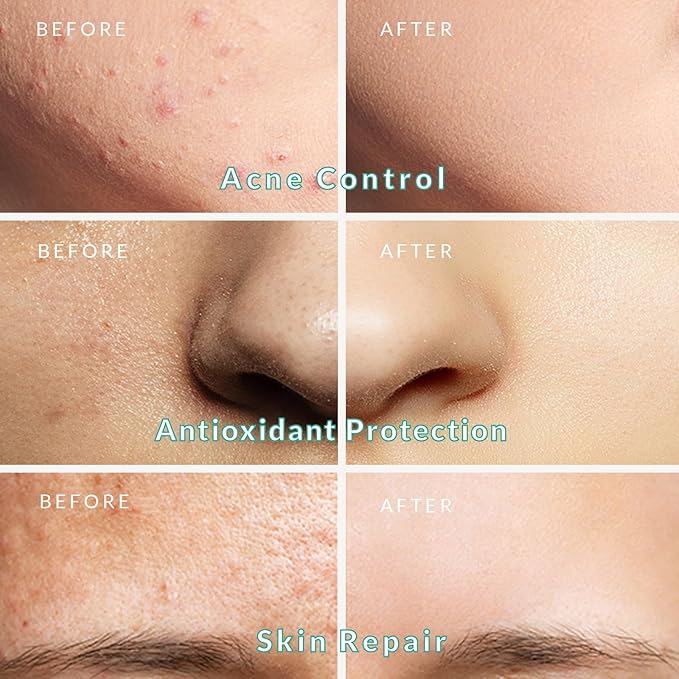 Organic Green Tea Clay Mud Mask - Soothing & Deep Cleansing Skincare, Hydrates & Brightens, Travel Size 2.8 oz