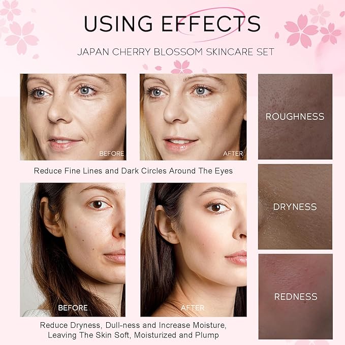 Skincare Set Japan Sakura Skin Care Set - Skincare Kits Gifts for Teen Girls, Travel Kit for Women Skin Care Routine Kit: Cleanser, Toner, Serum, Eye Cream, Face Cream, Beauty Christmas Gifts Set