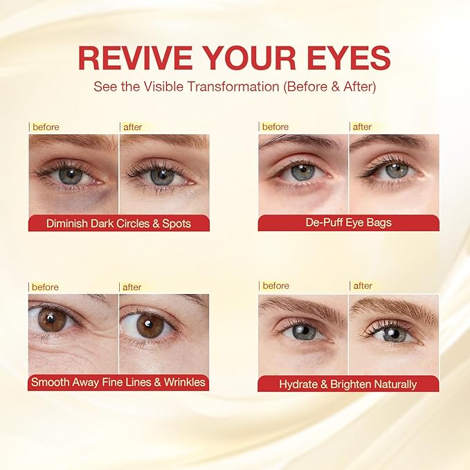 Under Eye Patches 360° Coverage, Eye Mask with Collagen Peptide, Retinol & Niacinamide, Eye Patches for Puffy Eyes and Dark Circles, Wrinkle Remover for Women, Individually Packaged 4 Pack