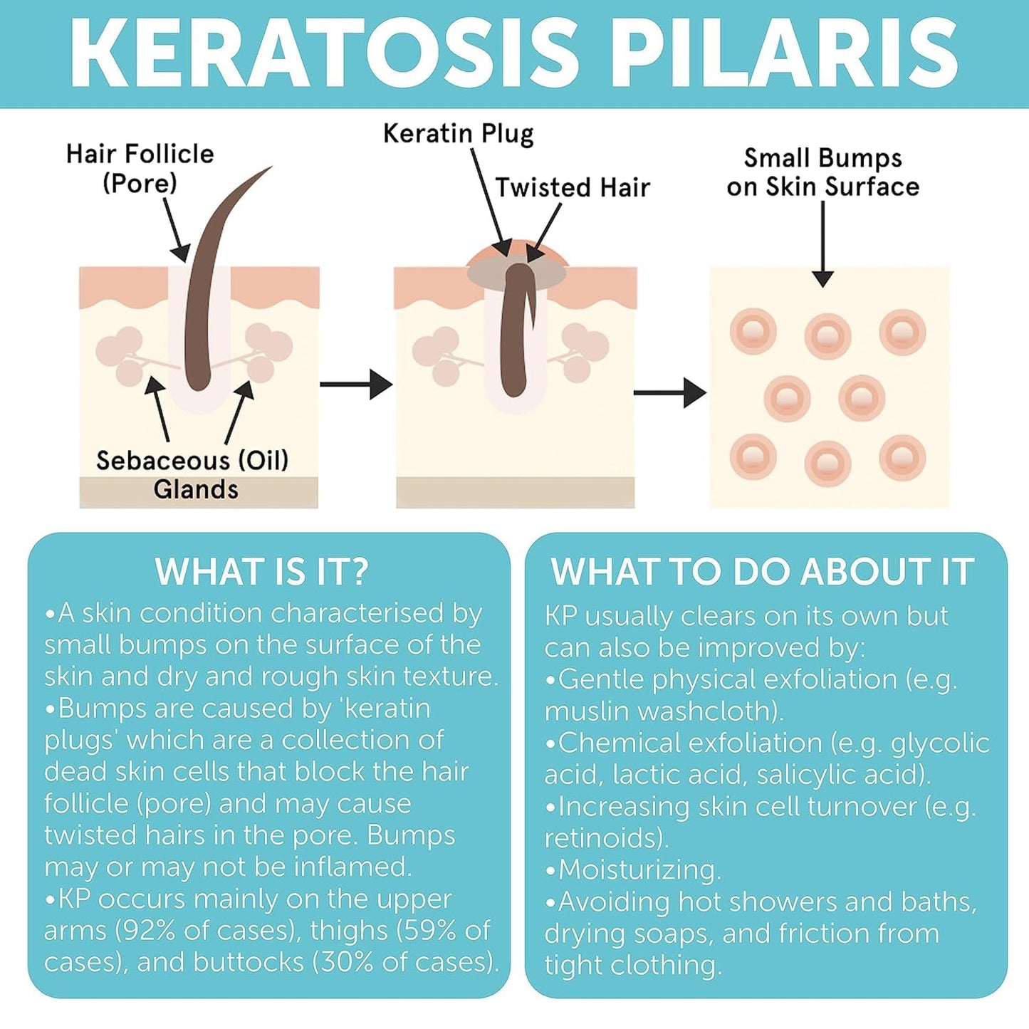 Keratosis Pilaris Treatment | Keratosis Pilaris Lotion | KP Lotion | Gentle Exfoliation For Strawberry Legs, KP & Ingrown Hairs | Smooth & Hydrating Body Lotion For Redness, Dry, Rough And Flaky Skin