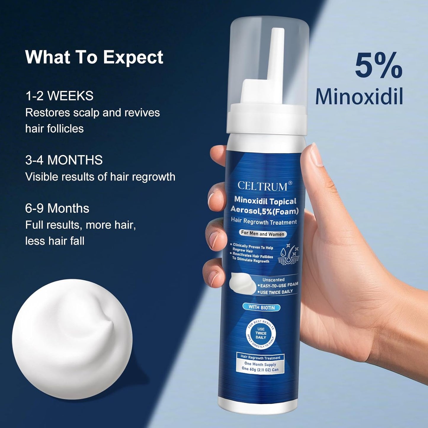 5% Topical Minoxidil Foam, Minoxidil for Men and Women, Infused with Biotin, Hair Growth Treatment, Supports Thicker and Fuller Hair & Beard (Minoxidil Foam, 8.44oz, 4 Month Supply)