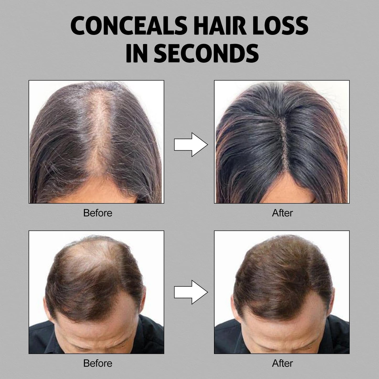 Ustar Hair Building Fibers for Thinning Hair 27.5g Conceals Hair Loss Instantly Thicker Fuller Look 9 Shades for Women & Men 2 Pack (Light Brown)